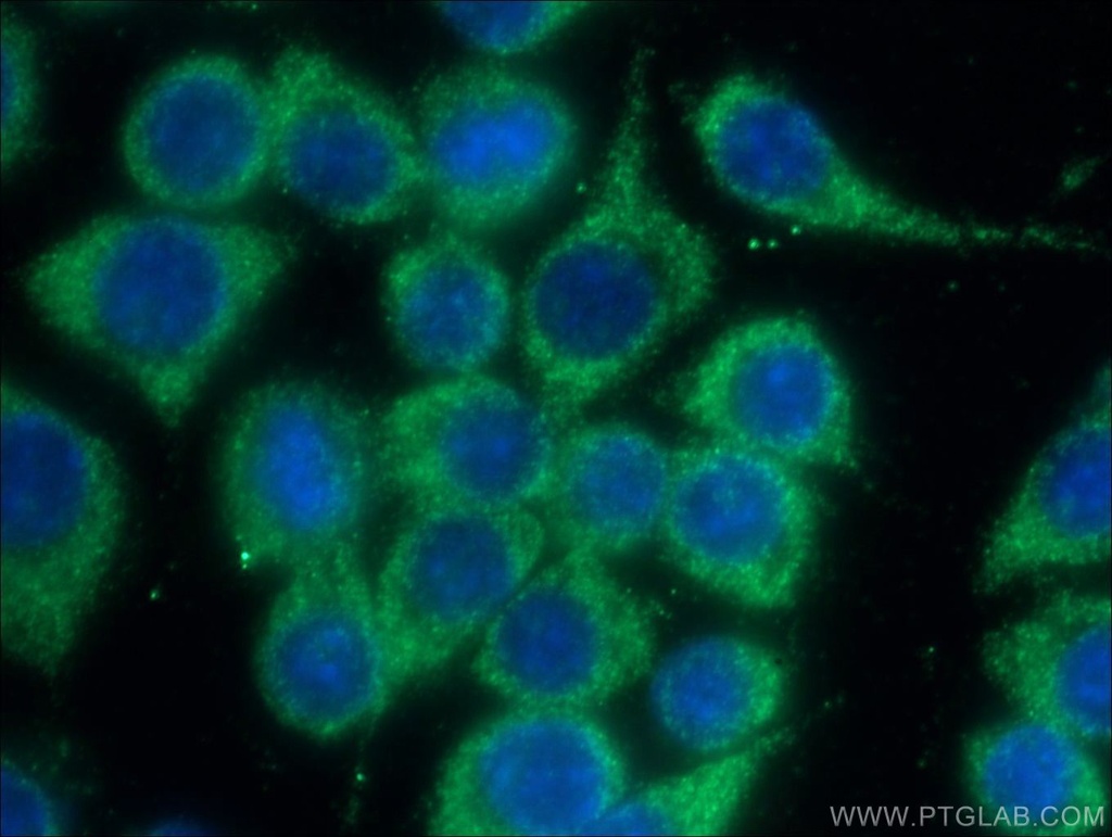 Chk2 Polyclonal antibody