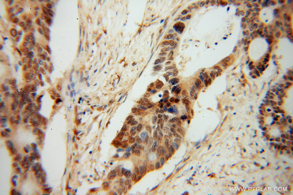 PDE8A Polyclonal antibody