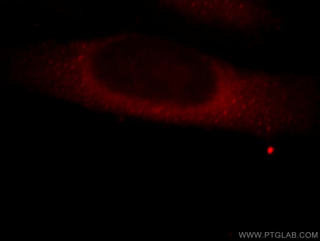 MICAL2 Polyclonal antibody