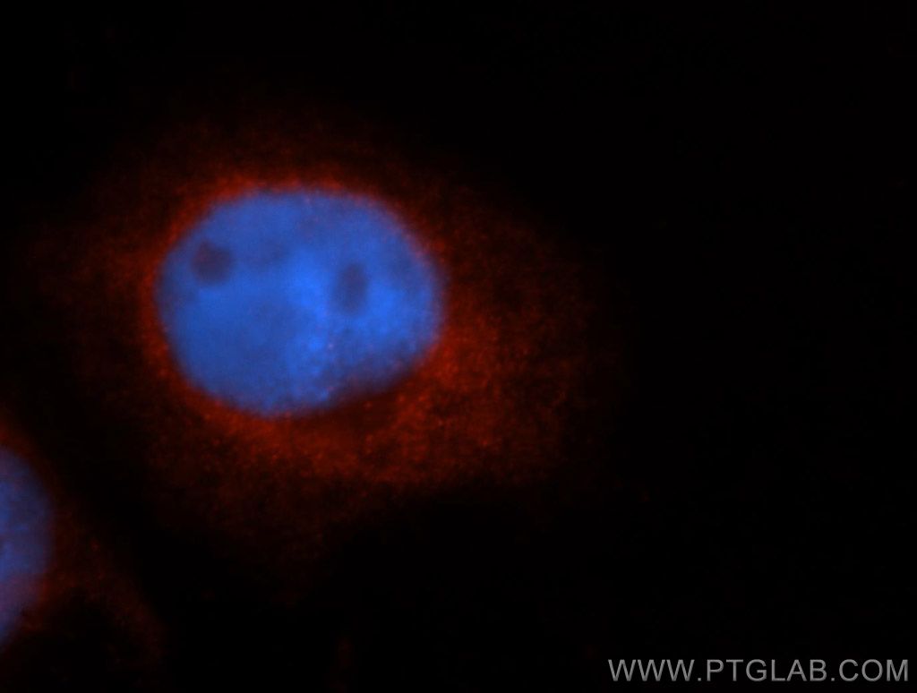 ZnT7 Polyclonal antibody