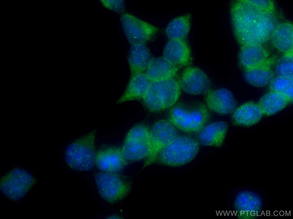 SEC63 Polyclonal antibody