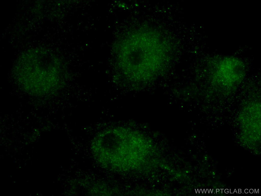 Cryptochrome 2 Polyclonal antibody