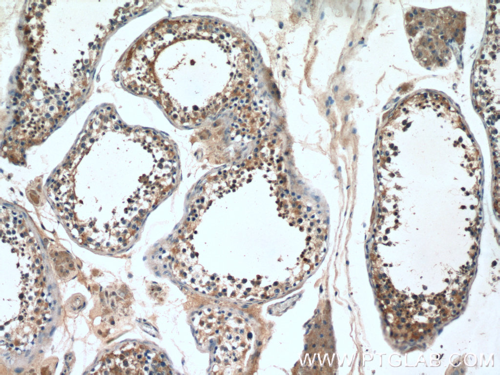PPP3R2 Polyclonal antibody