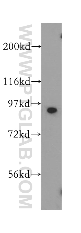 SOX6 Polyclonal antibody