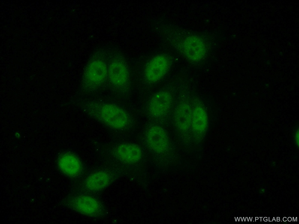 NFKBIZ Polyclonal antibody