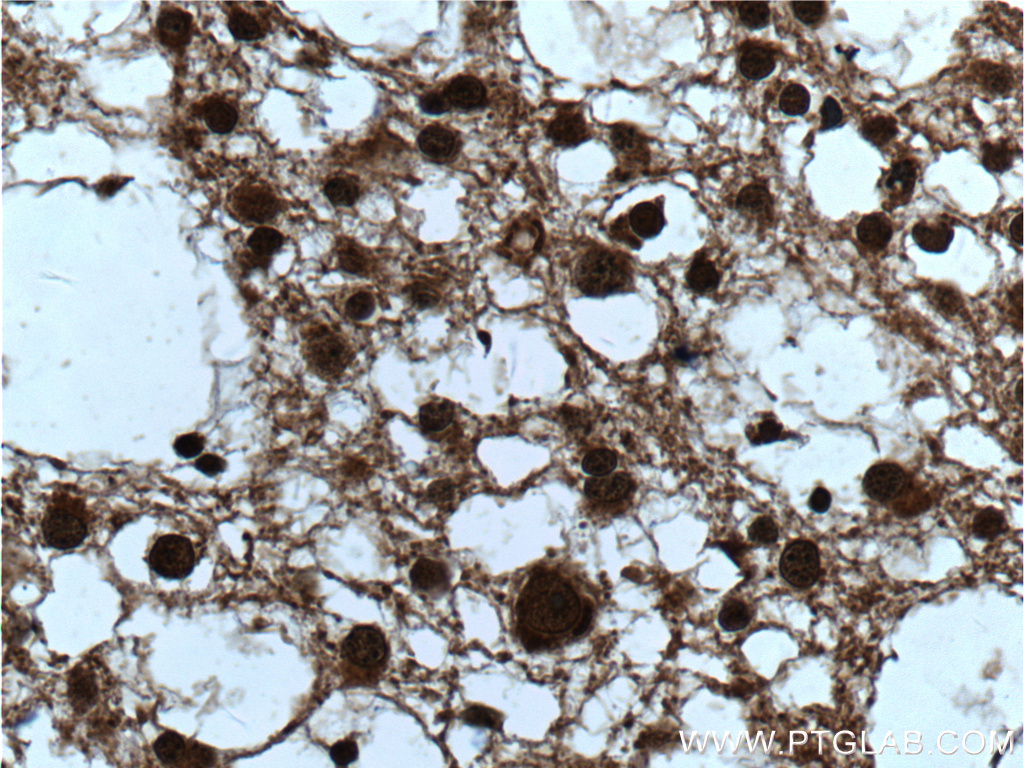 ZEB2 Polyclonal antibody