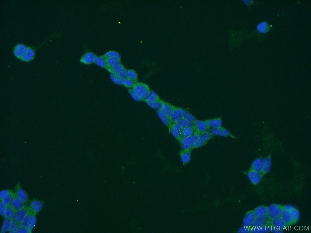 HLCS Polyclonal antibody
