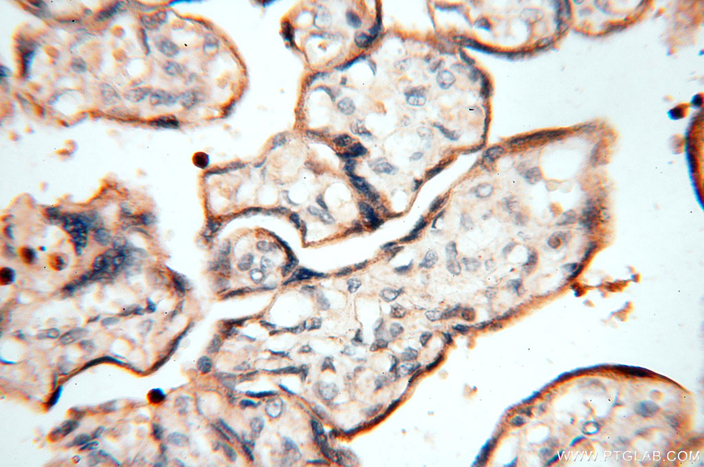 MAN1A2 Polyclonal antibody