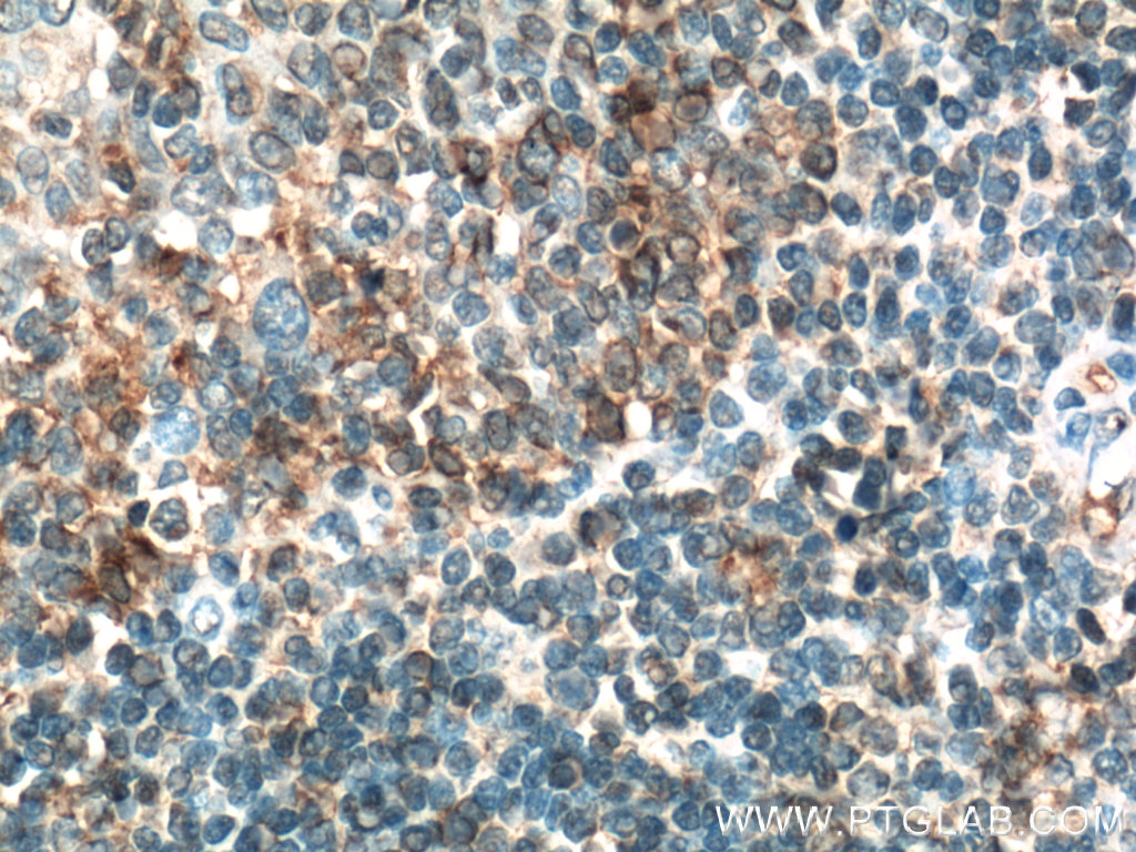 CD200 Polyclonal antibody