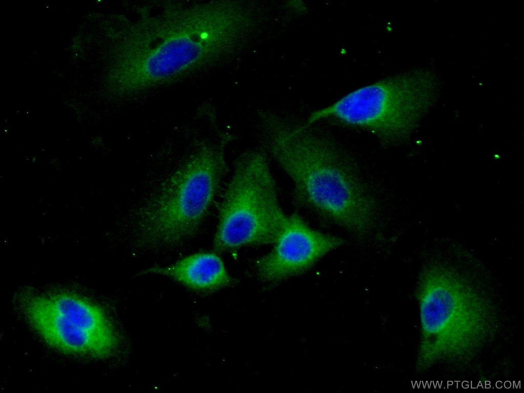 CCP1 Polyclonal antibody