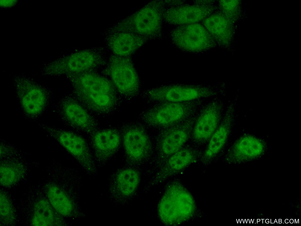 INTS5 Polyclonal antibody