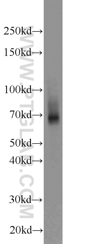 ZNF354A Polyclonal antibody