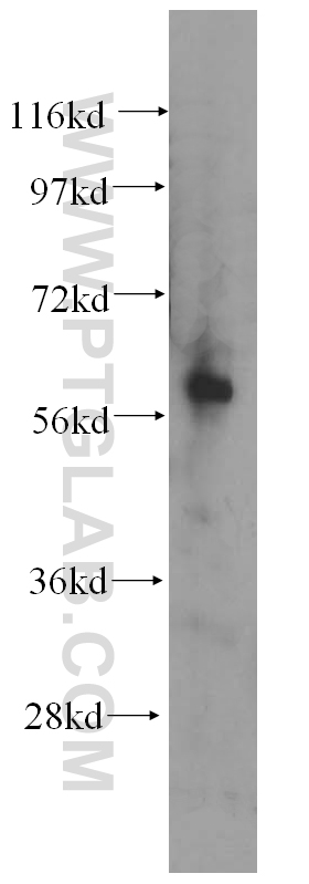 AMIGO2 Polyclonal antibody