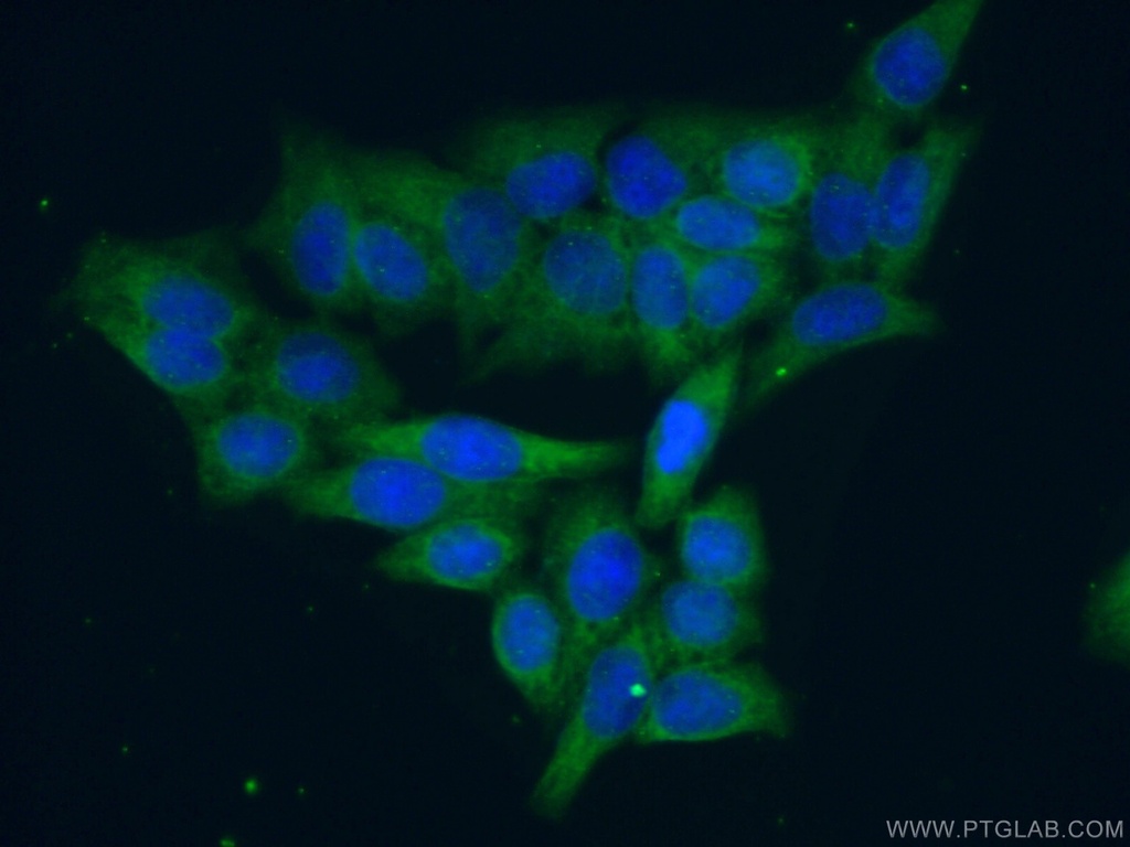 UBE2R2 Polyclonal antibody