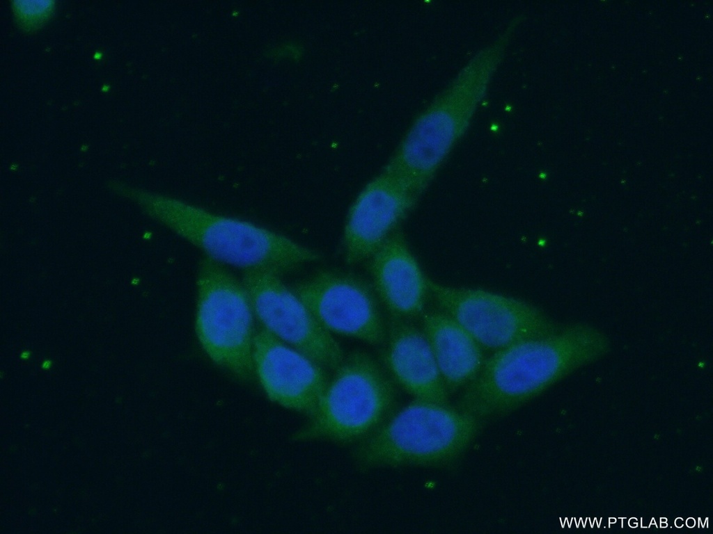 SREBF1 Polyclonal antibody
