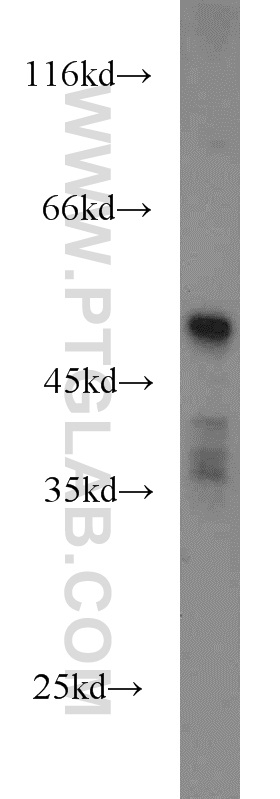 HTRA4 Polyclonal antibody