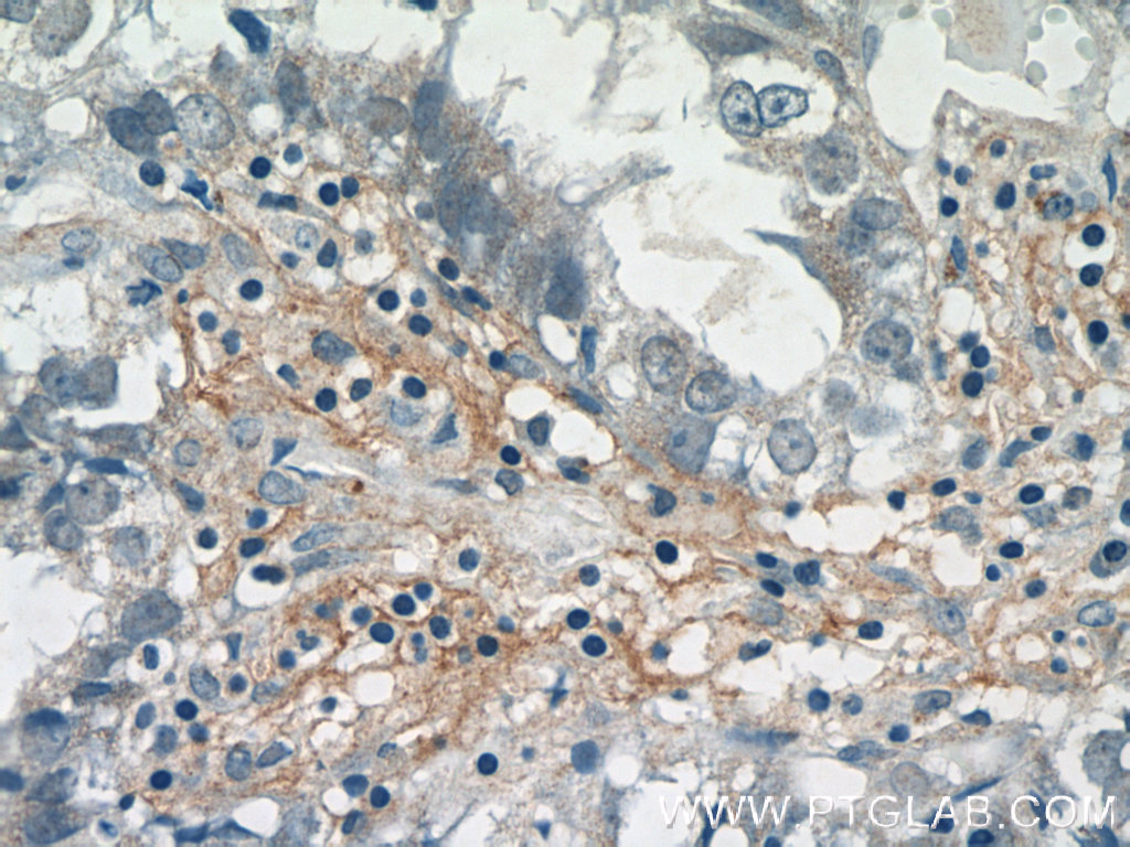 PRR13 Polyclonal antibody
