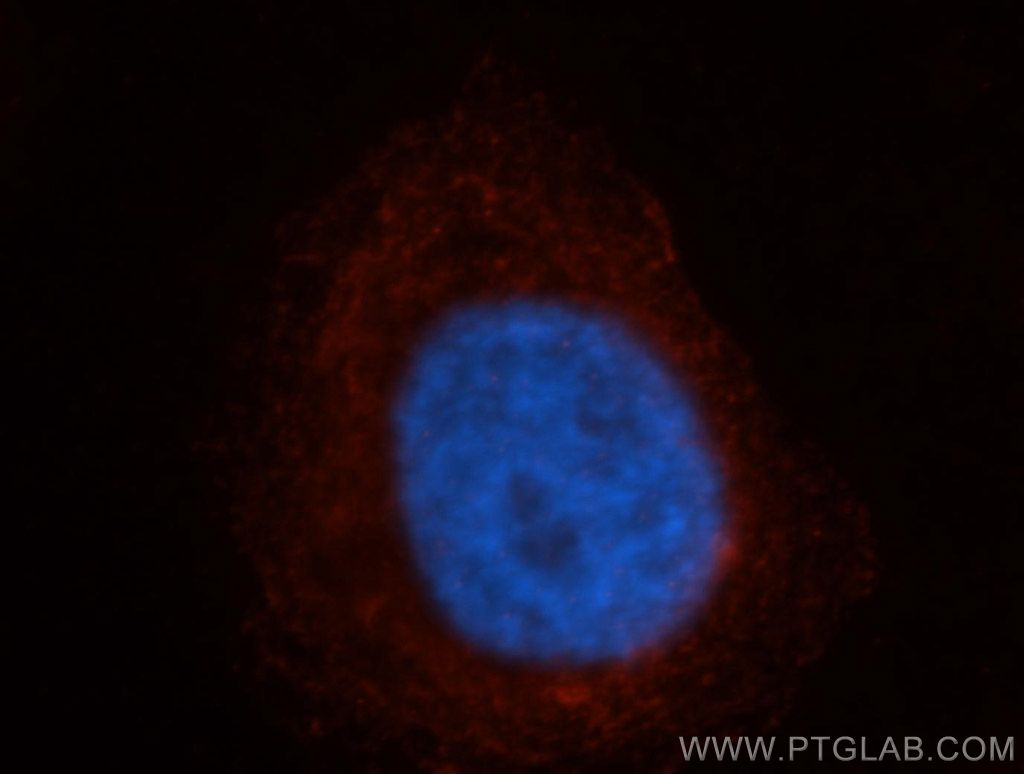 NAPB Polyclonal antibody
