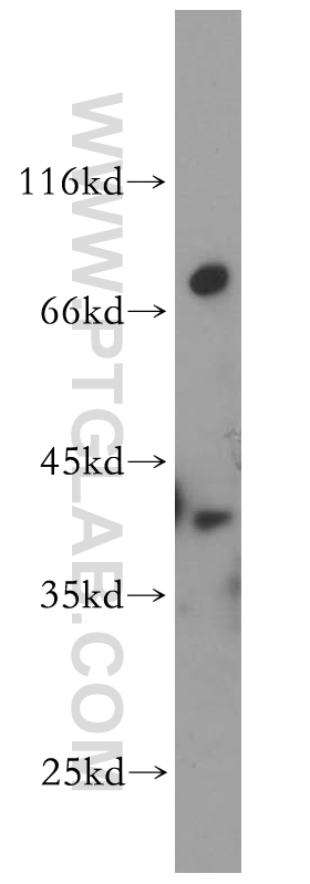 DOK6 Polyclonal antibody
