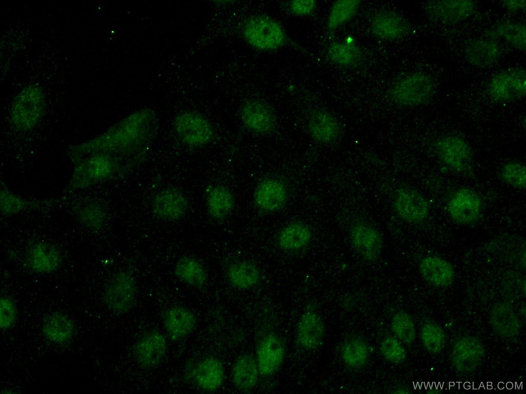 FOXR2 Polyclonal antibody