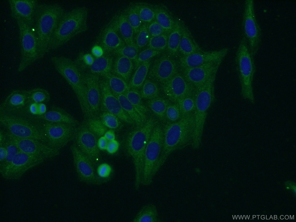 FADS Polyclonal antibody
