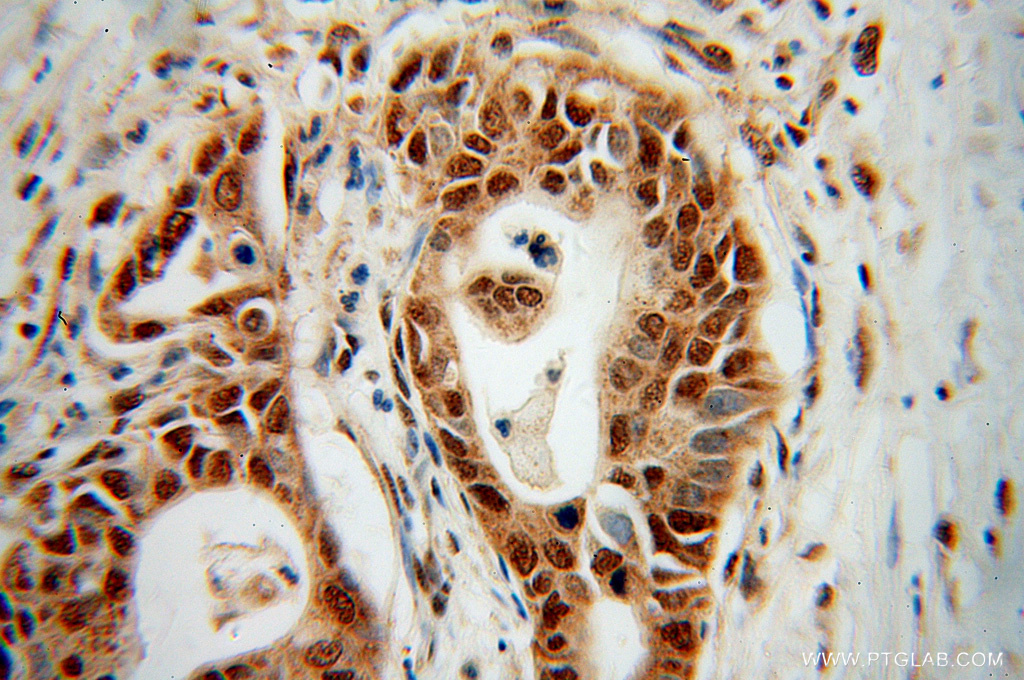 RPL17 Polyclonal antibody