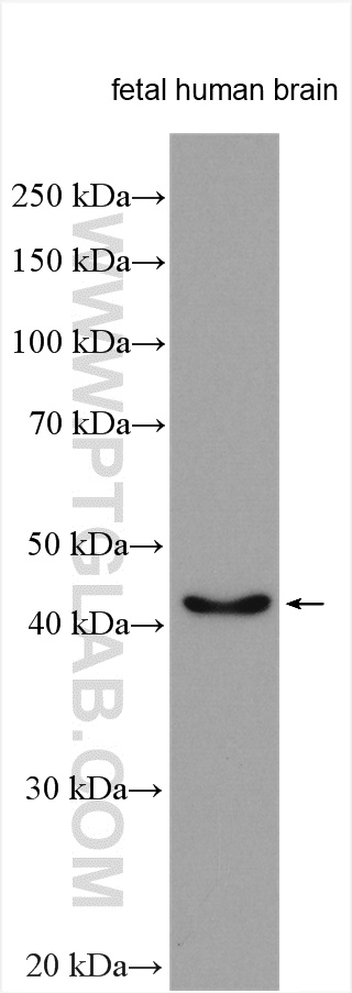 MARCKSL1 Polyclonal antibody