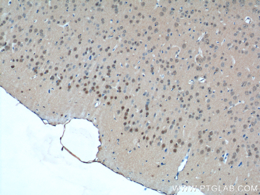 CDC26 Polyclonal antibody