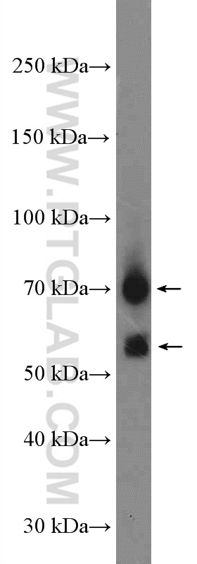 CHST15 Polyclonal antibody