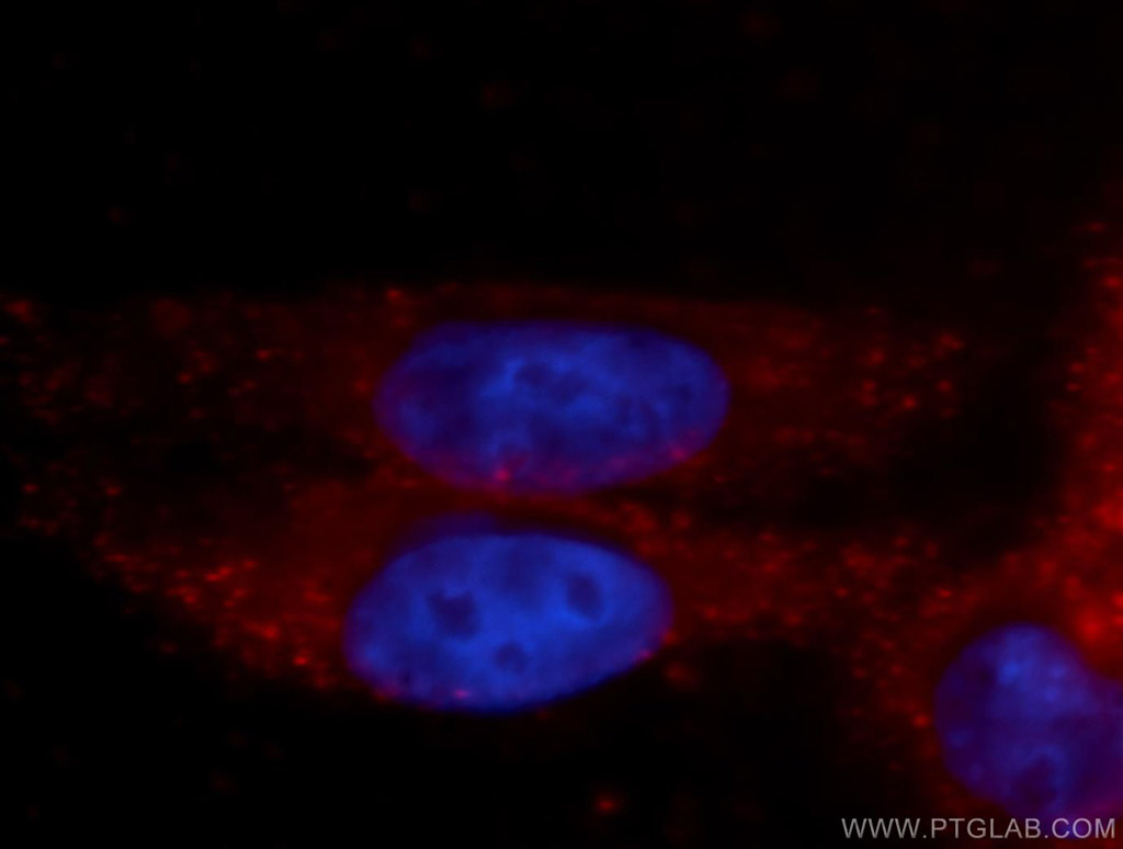 GFPT1 Polyclonal antibody
