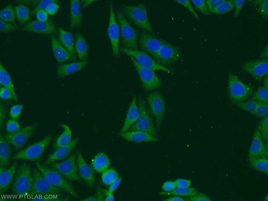 TMED4 Polyclonal antibody