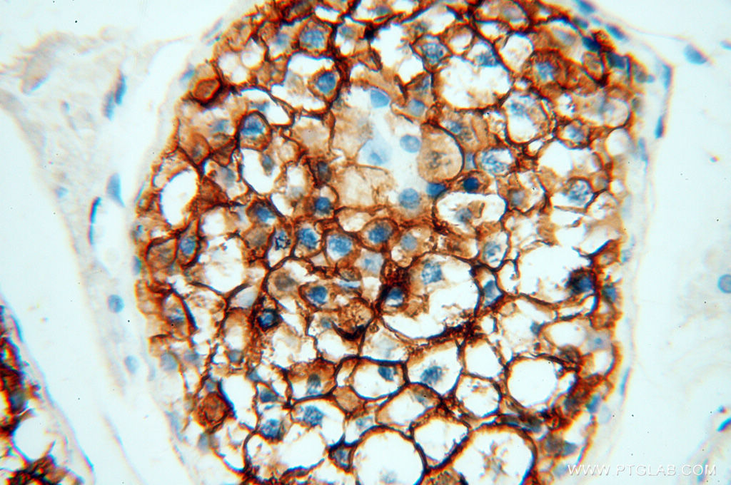 VSIG1 Polyclonal antibody
