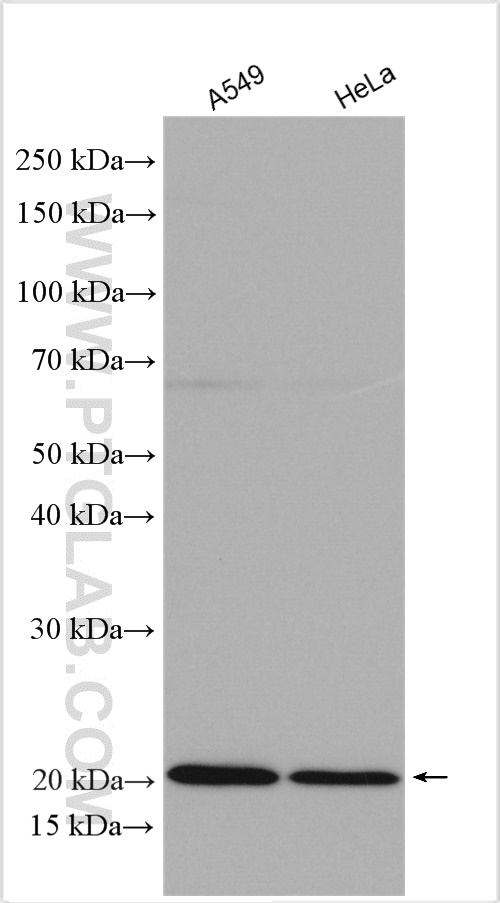 IL-18BP Polyclonal antibody