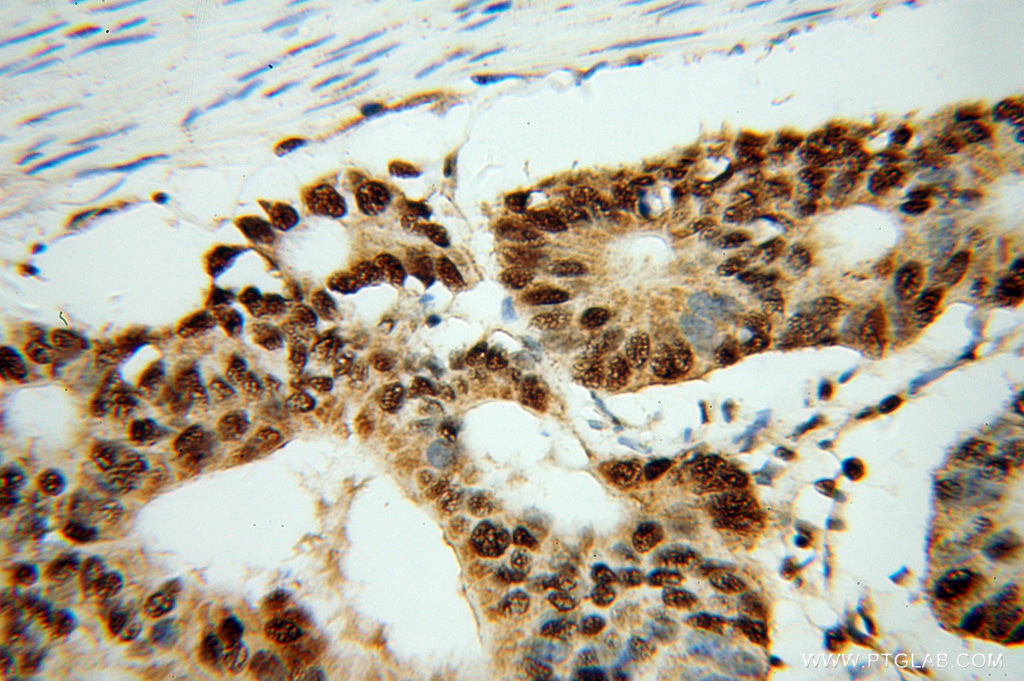 FKBP5 Polyclonal antibody