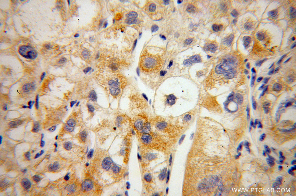 MIPOL1 Polyclonal antibody