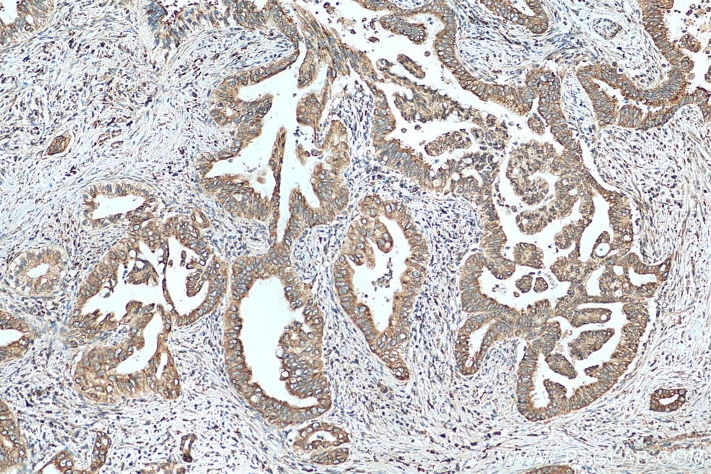 UGCGL1 Polyclonal antibody