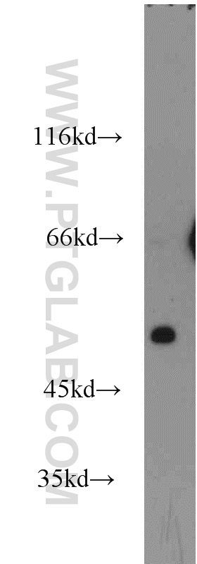SCTR Polyclonal antibody