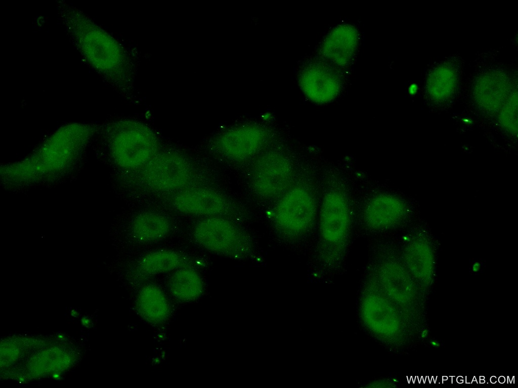 SMC3 Polyclonal antibody