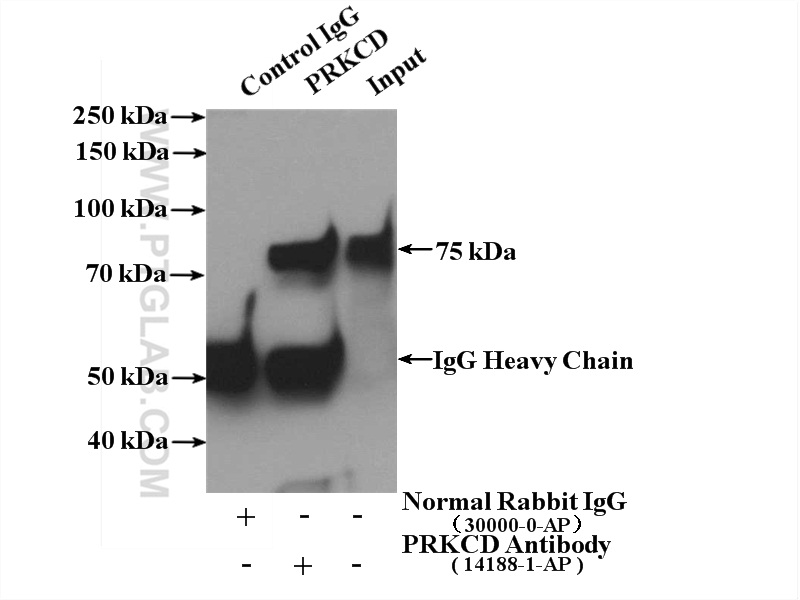 PKC Delta Polyclonal antibody