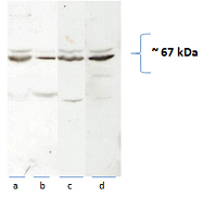 CAT-1 Polyclonal antibody