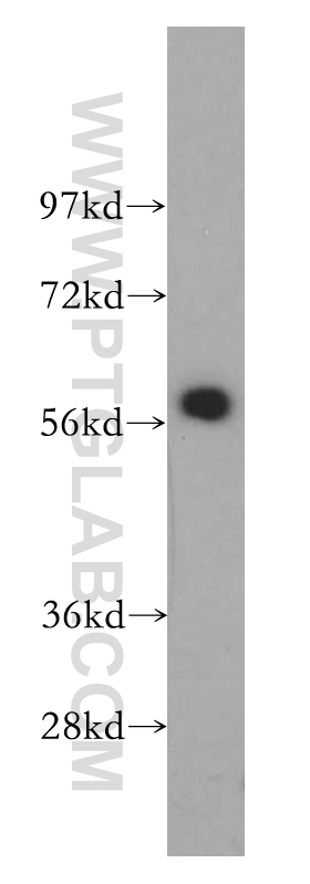 CREB5 Polyclonal antibody