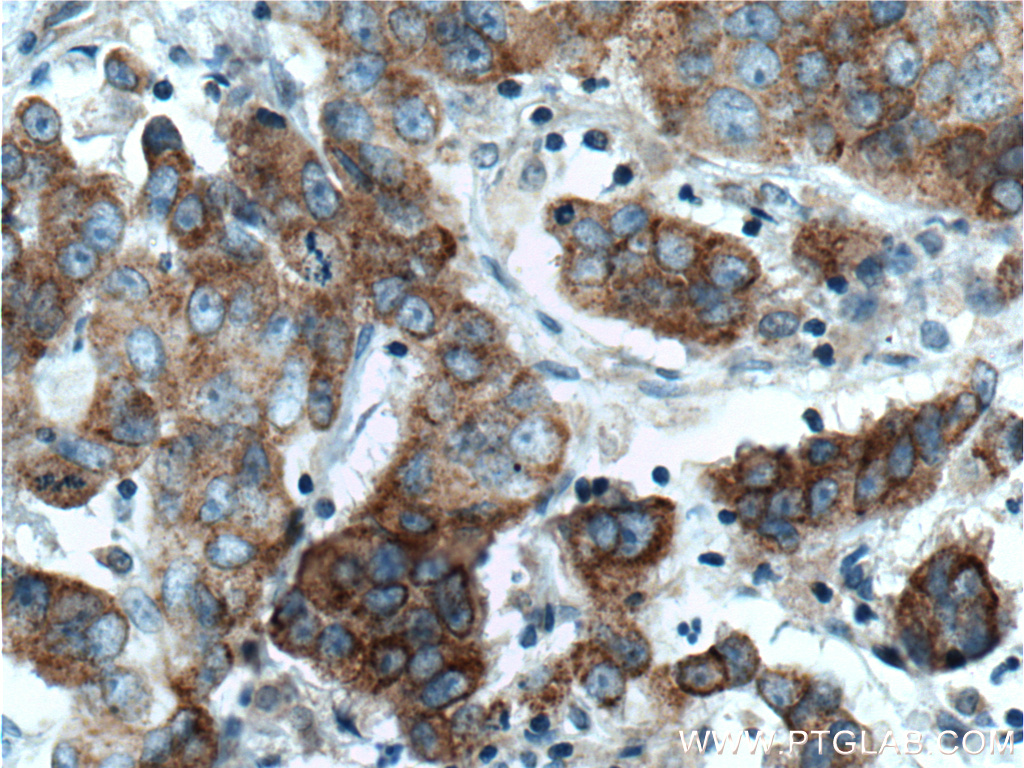 TNK1 Polyclonal antibody