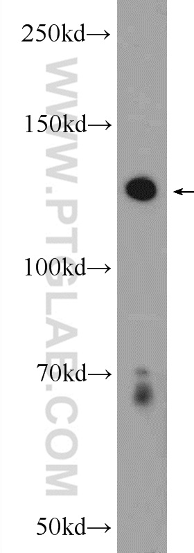 PLEKHH2 Polyclonal antibody