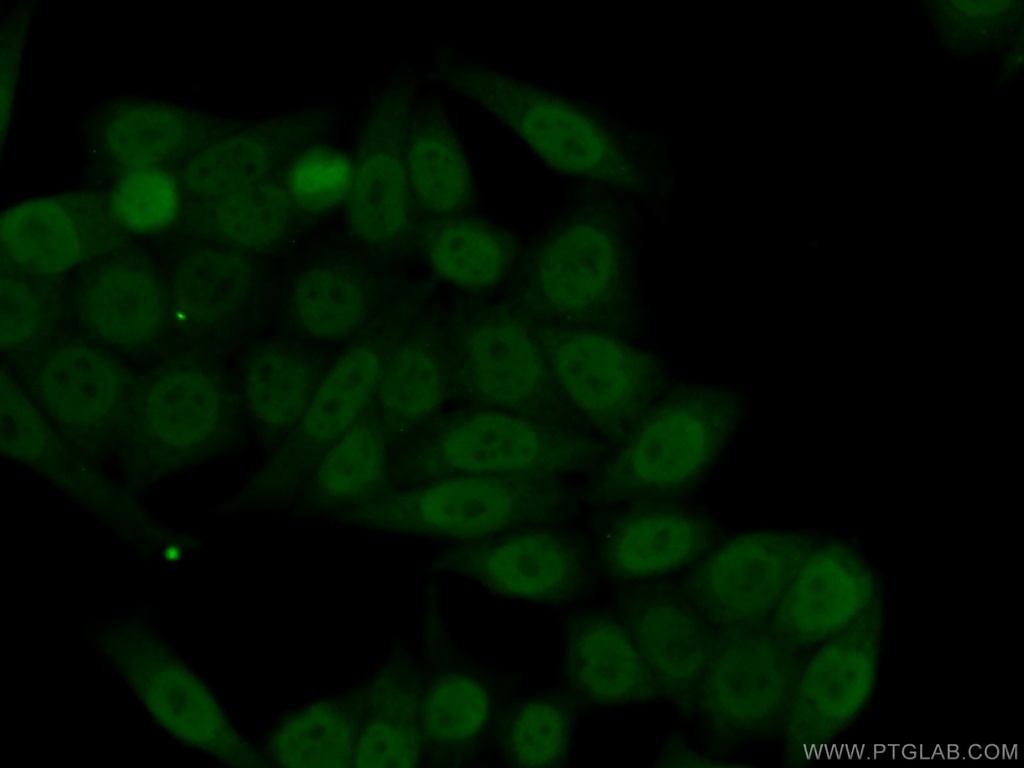 TRIM24 Polyclonal antibody