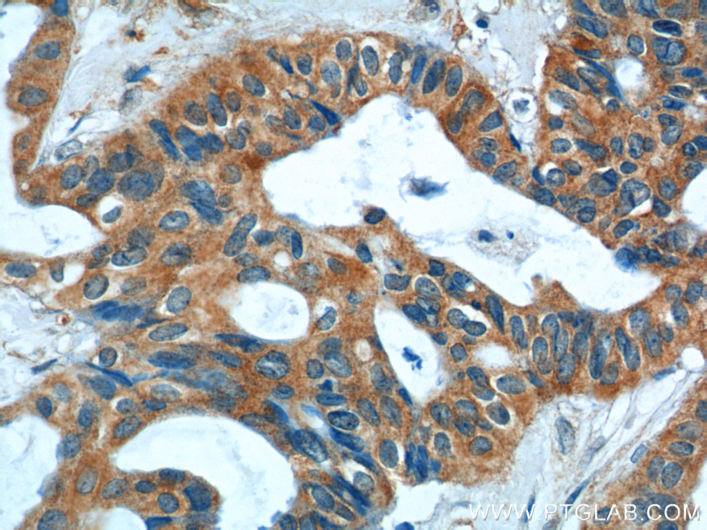 S100A9 Polyclonal antibody