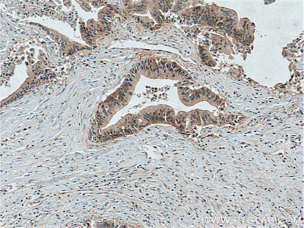 LIV-1/ZIP6 Polyclonal antibody