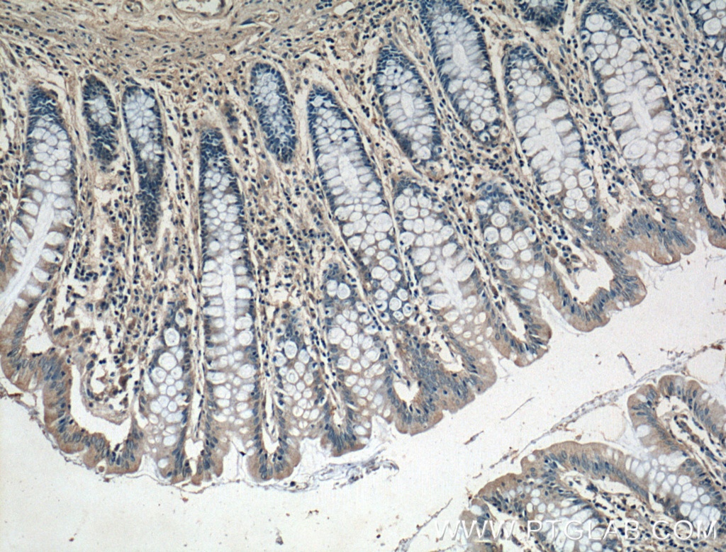 DUSP16 Polyclonal antibody
