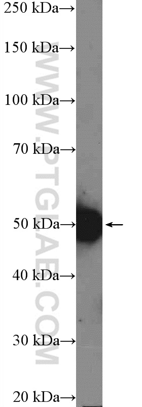 RBMY1A1 Polyclonal antibody