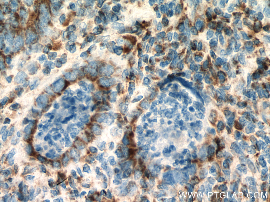 SUCLG2 Polyclonal antibody