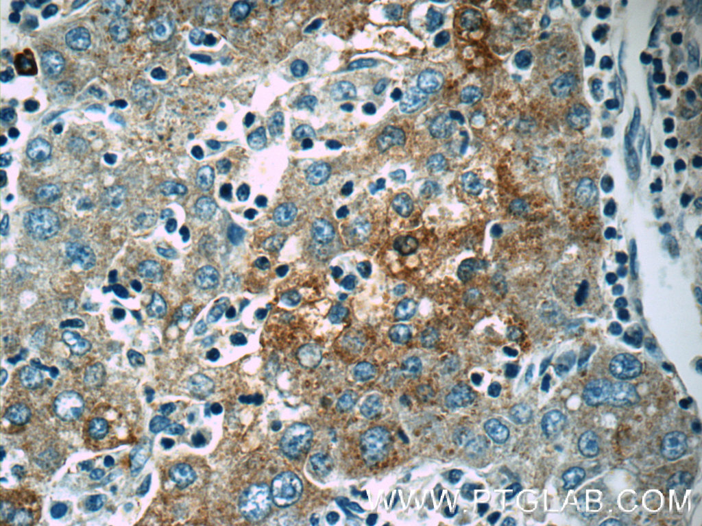 Autotaxin Polyclonal antibody